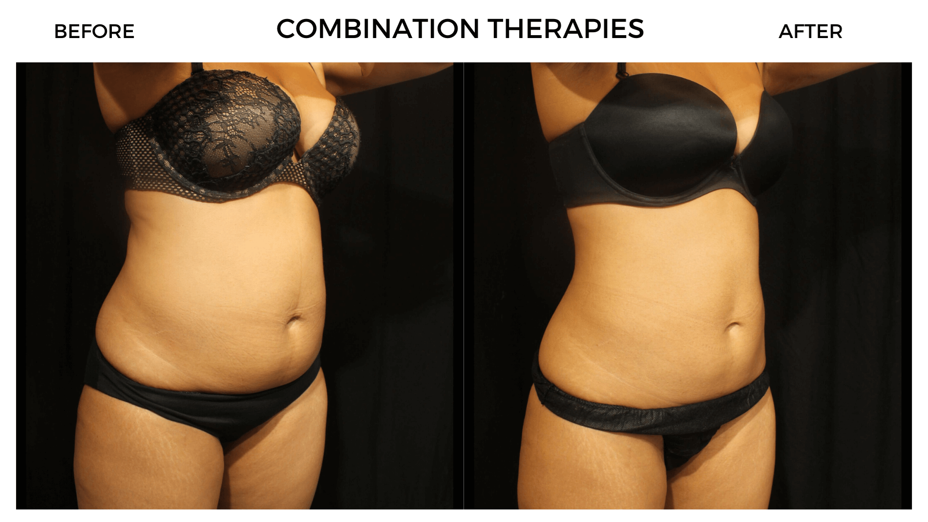 The Body Clinic Combination Th